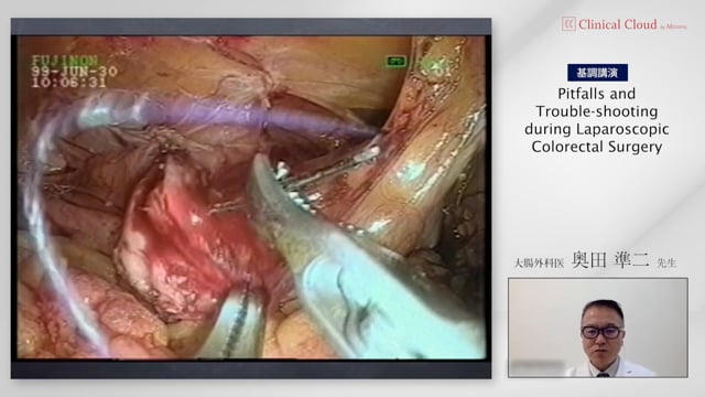 Pitfalls and Trouble-shooting during Lapaloscopic Colorectal Surgery