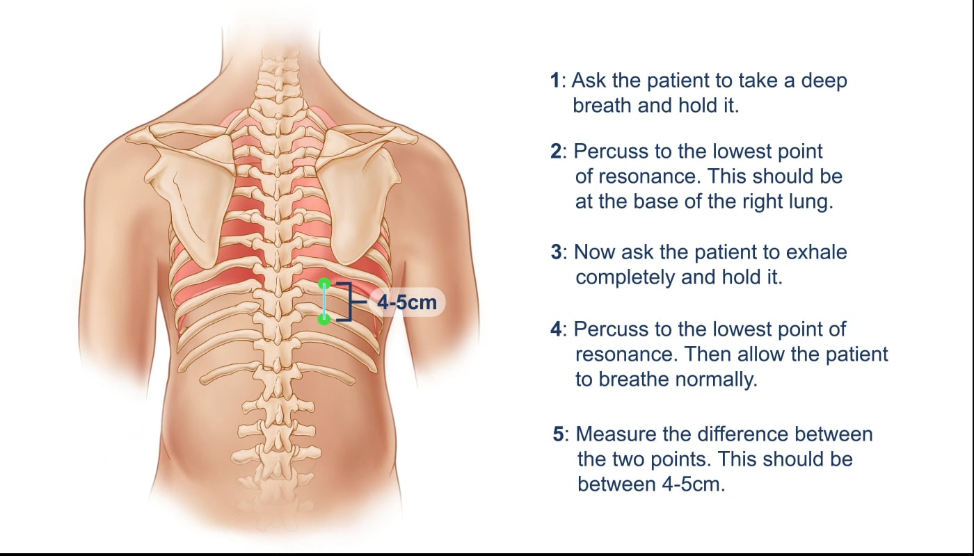 diaphragmatic excursion dyspnea