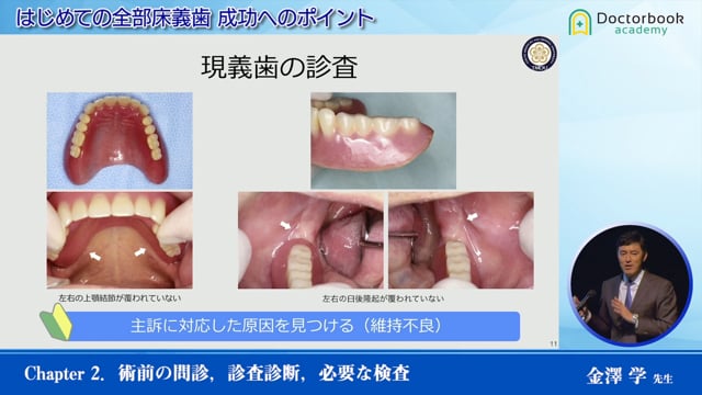 はじめての全部床義歯 成功へのポイント | Doctorbook academy 