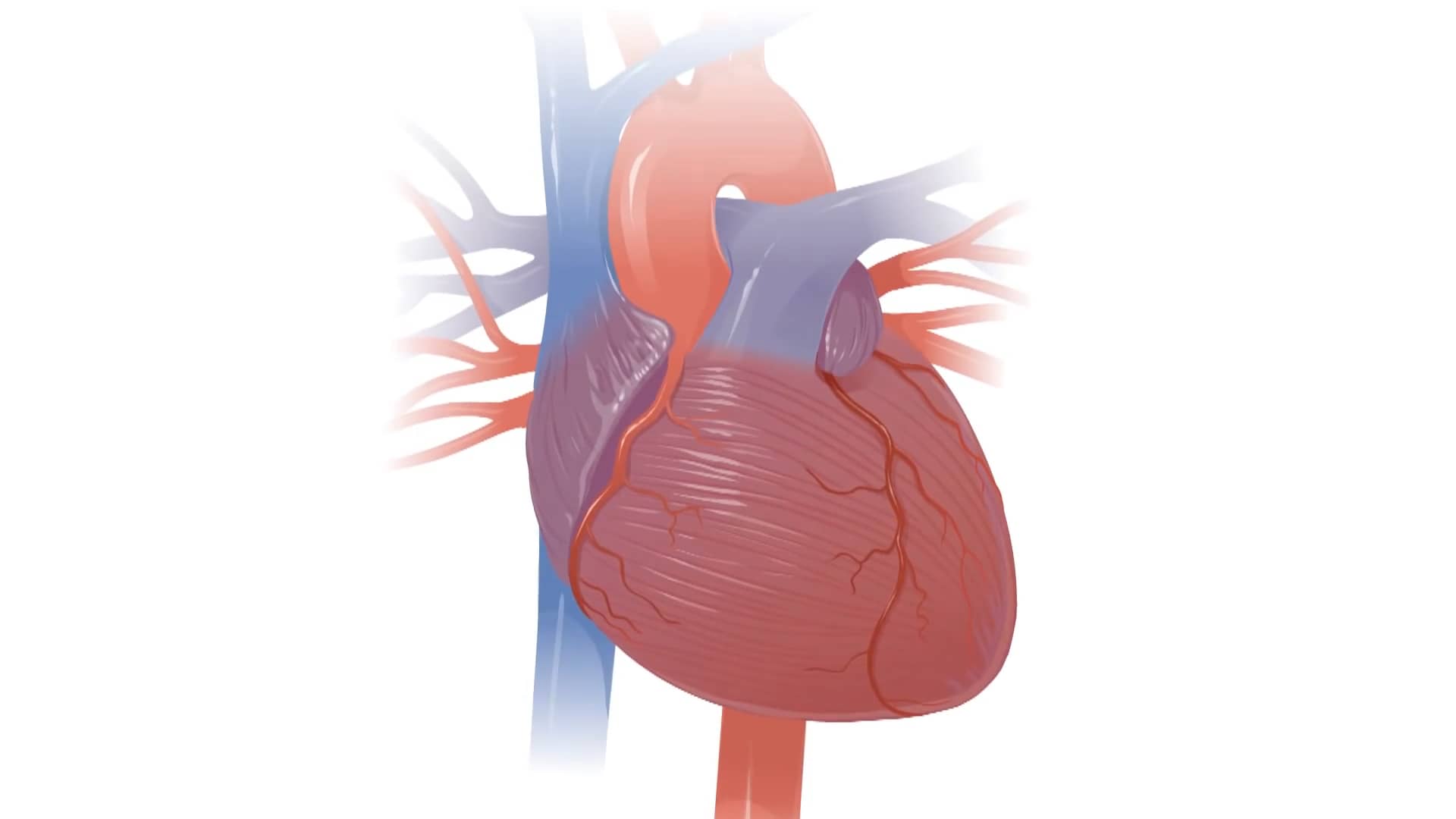 Zoll Life Vest on Vimeo