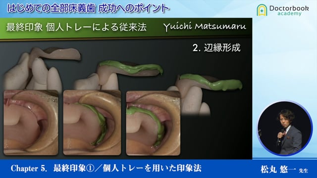 #5 最終印象①／個人トレーを用いた印象法