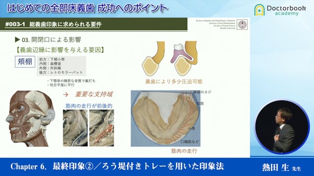 #6 最終印象②／ろう堤付きトレーを用いた印象法