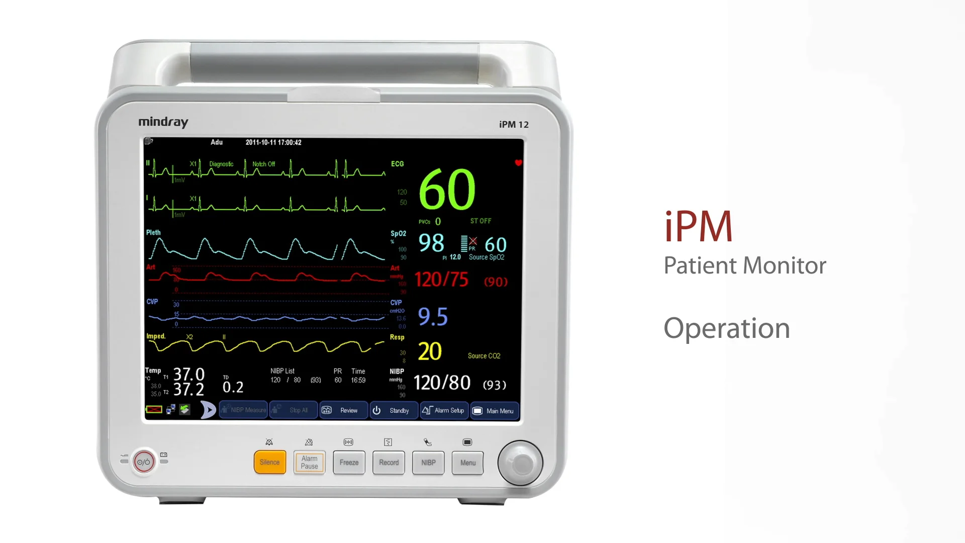 Patient Monitoring Systems : Patient Monitors by Mindray