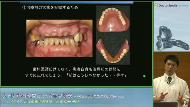 #1 歯科臨床における写真撮影の必要性