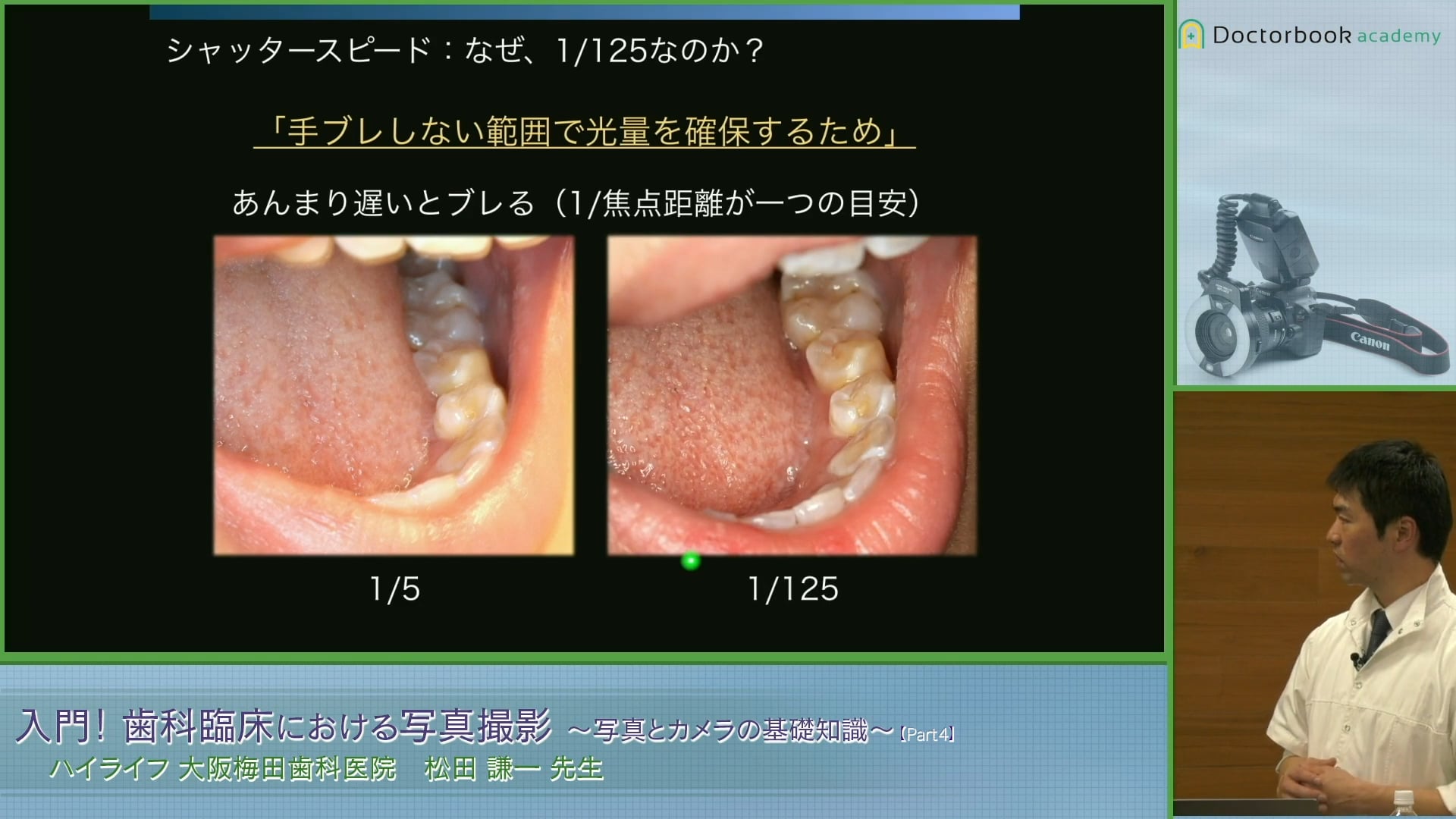 #4 口腔内写真撮影時のカメラの設定