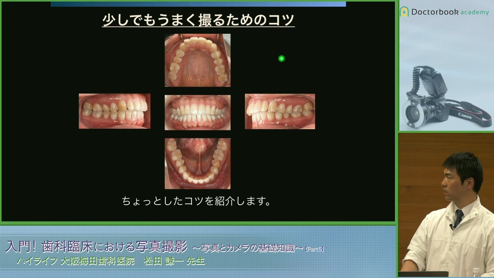 #5 口腔内写真５枚法撮影のコツ