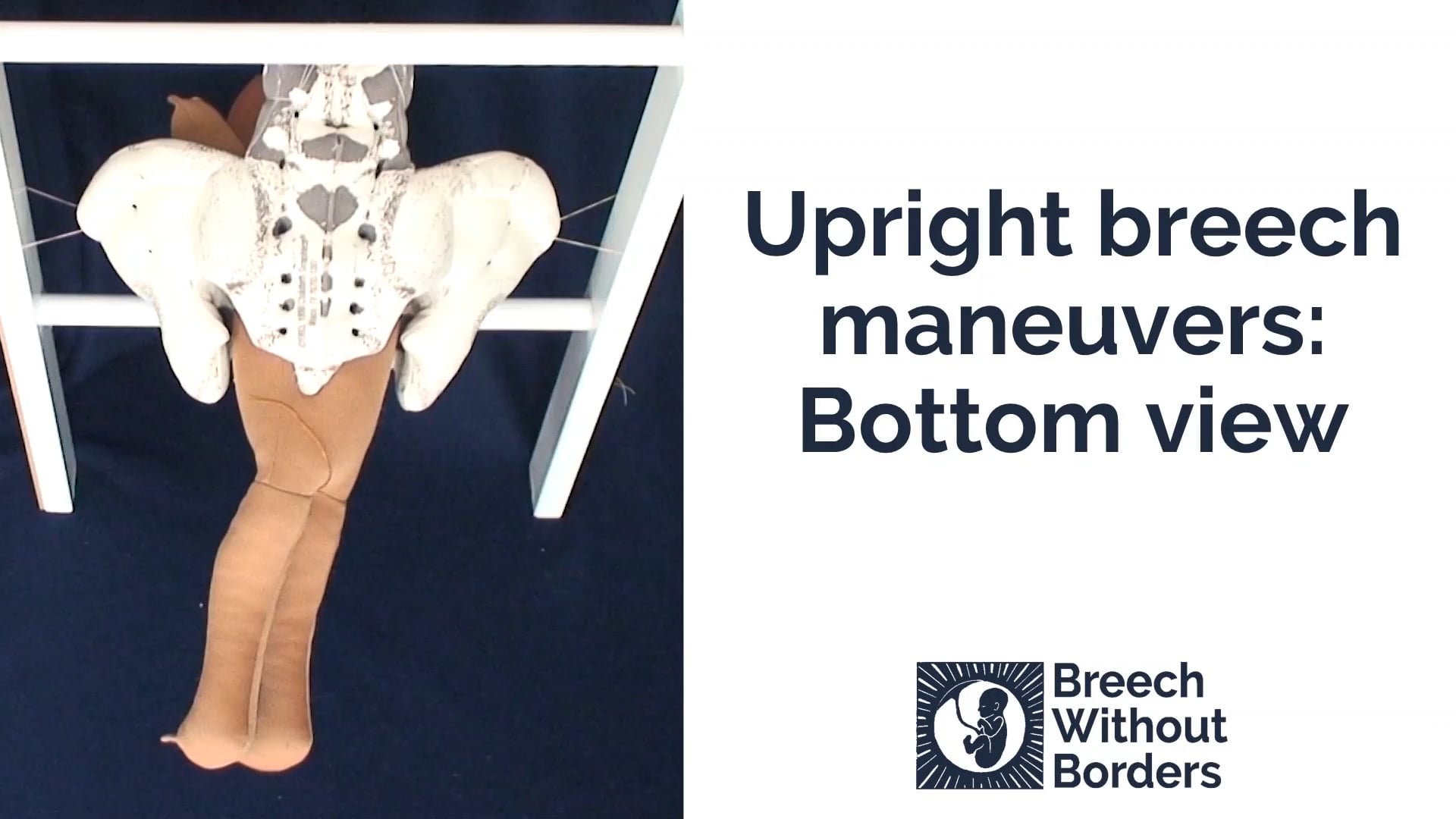 Upright breech maneuvers: bottom view (doll & pelvis) on Vimeo