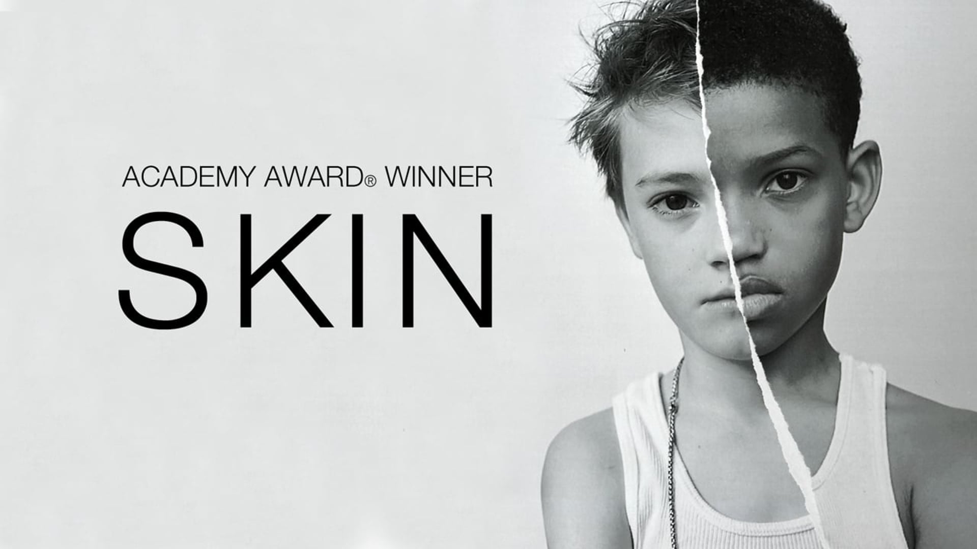 S K I N Trailer