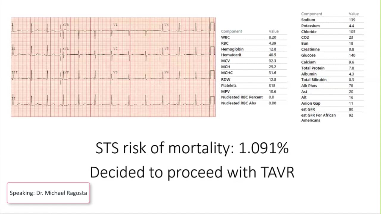 STS Score on Vimeo