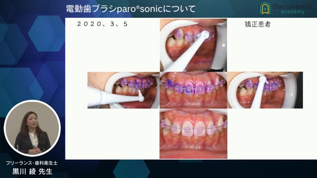 電動歯ブラシparo®sonicについて