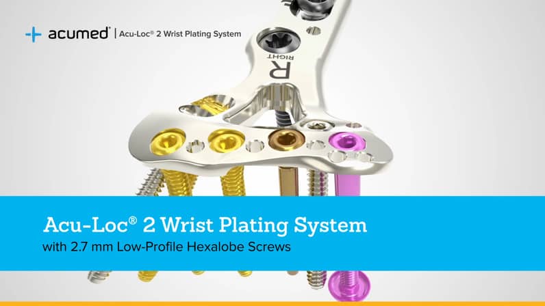 Acu Loc 2 Wrist Plating System Acumed