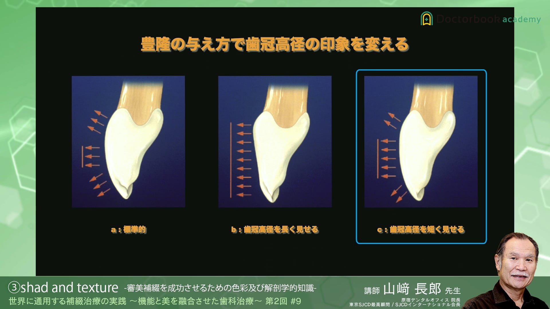 #9 Shade and Texture -審美補綴を成功させるための色彩及び解剖学的知識-
