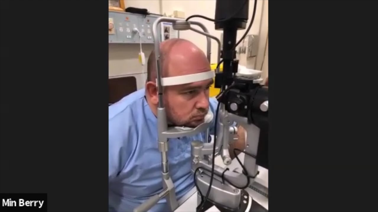 The Slit Lamp and Fundoscopy Camera on Vimeo