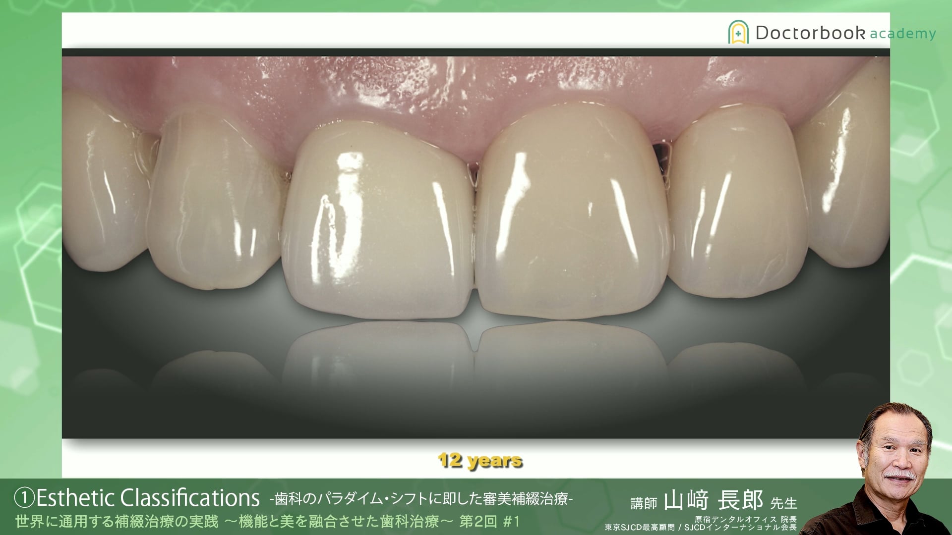 #1 Esthetic Classifications -歯科のパラダイム・シフトに即した審美補綴治療-