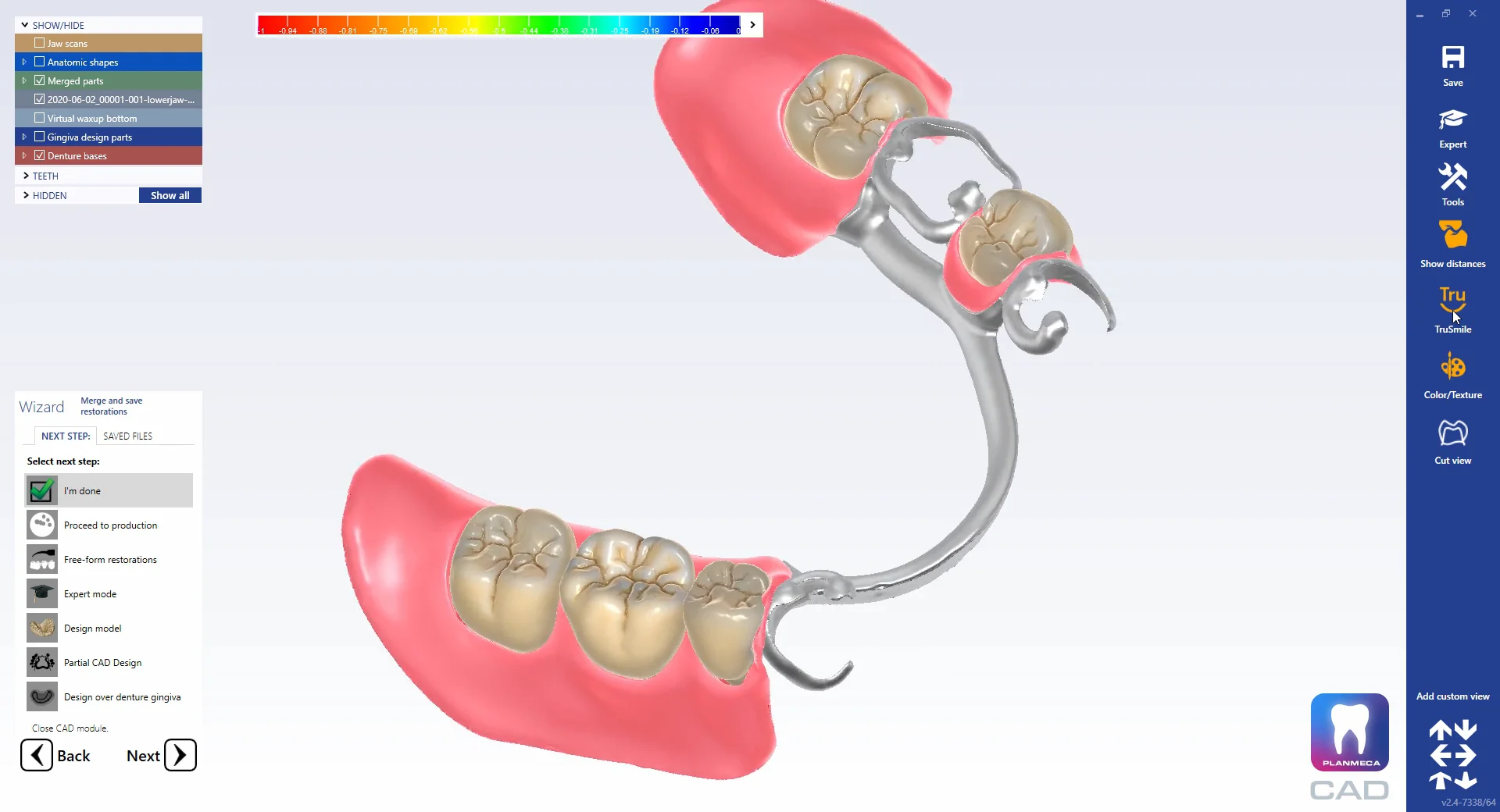 How to design partial dentures in Planmeca PlanCAD® Premium on Vimeo
