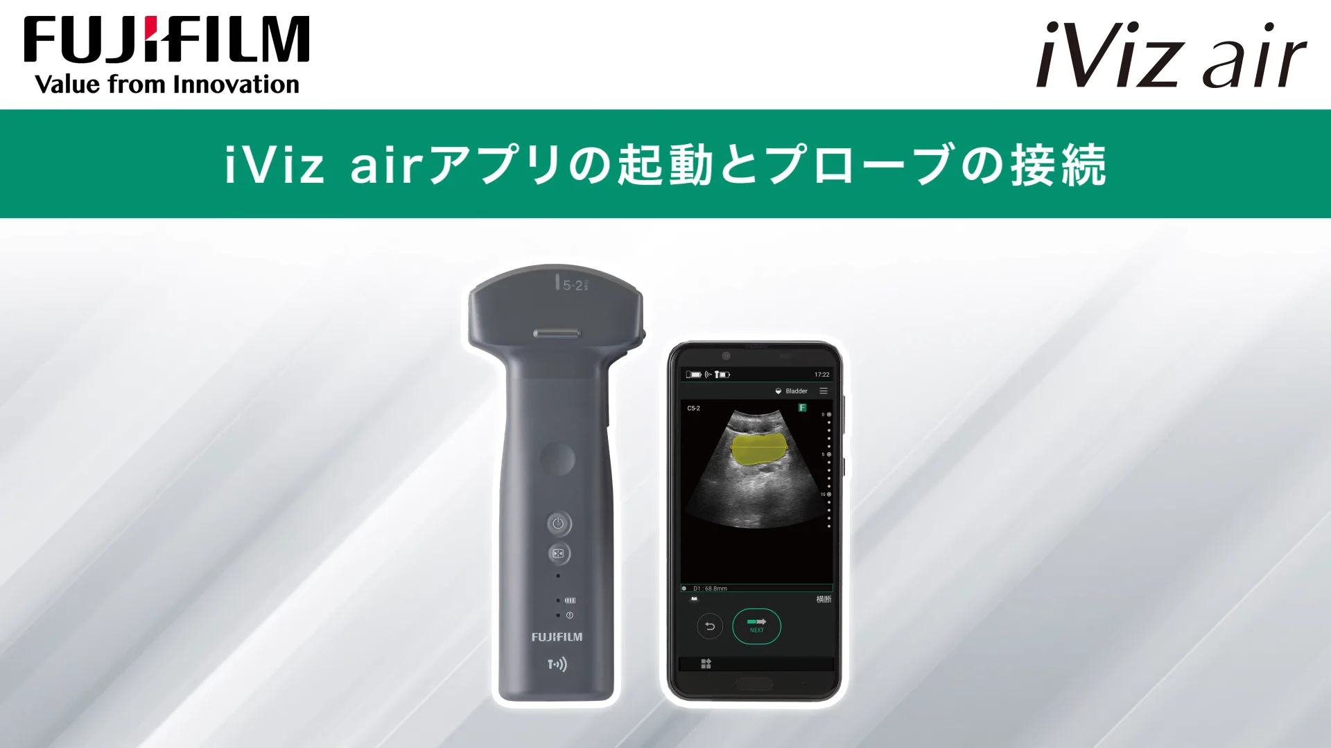 iViz air リニア:使い方動画 | 富士フイルム [日本]