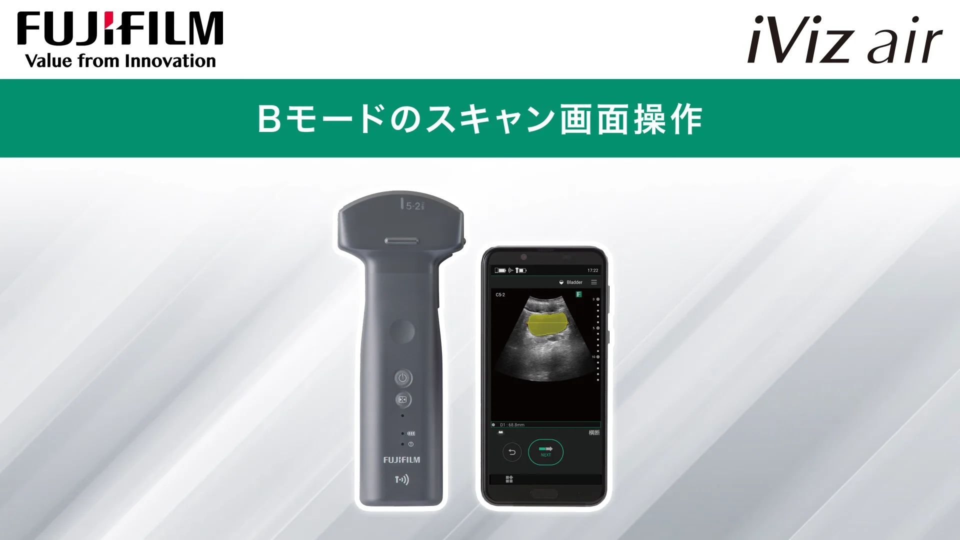 ポータブルエコー 超音波 コンベックス 保証期間中 説明書