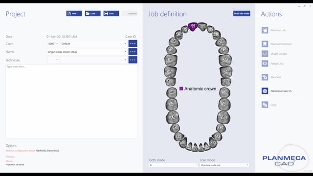 Planmeca CAD/CAM on Vimeo