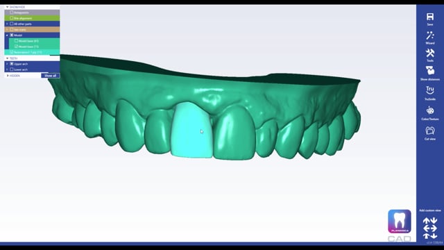 Planmeca CAD/CAM on Vimeo