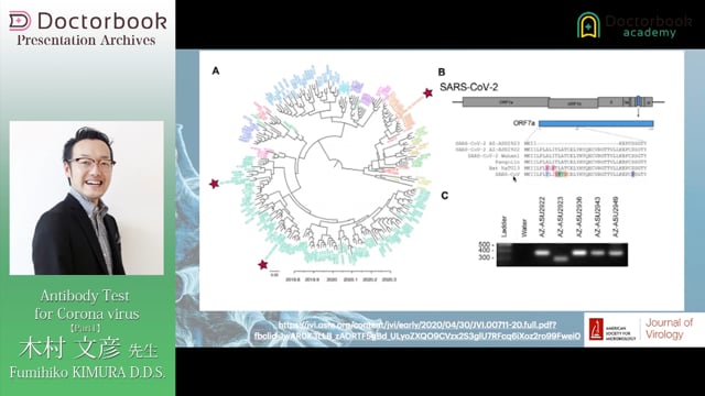 Antibody Test for Corona virus