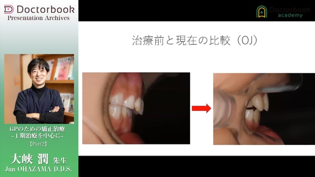 GPのための矯正治療 -Ⅰ期治療を中心に- | Doctorbook academy