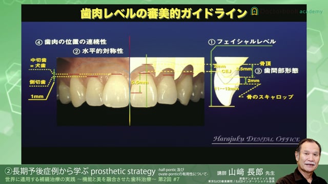 #7 長期予後症例から学ぶ prosthetic strategy -half-pontic 及び ovate-pontic の有用性について-