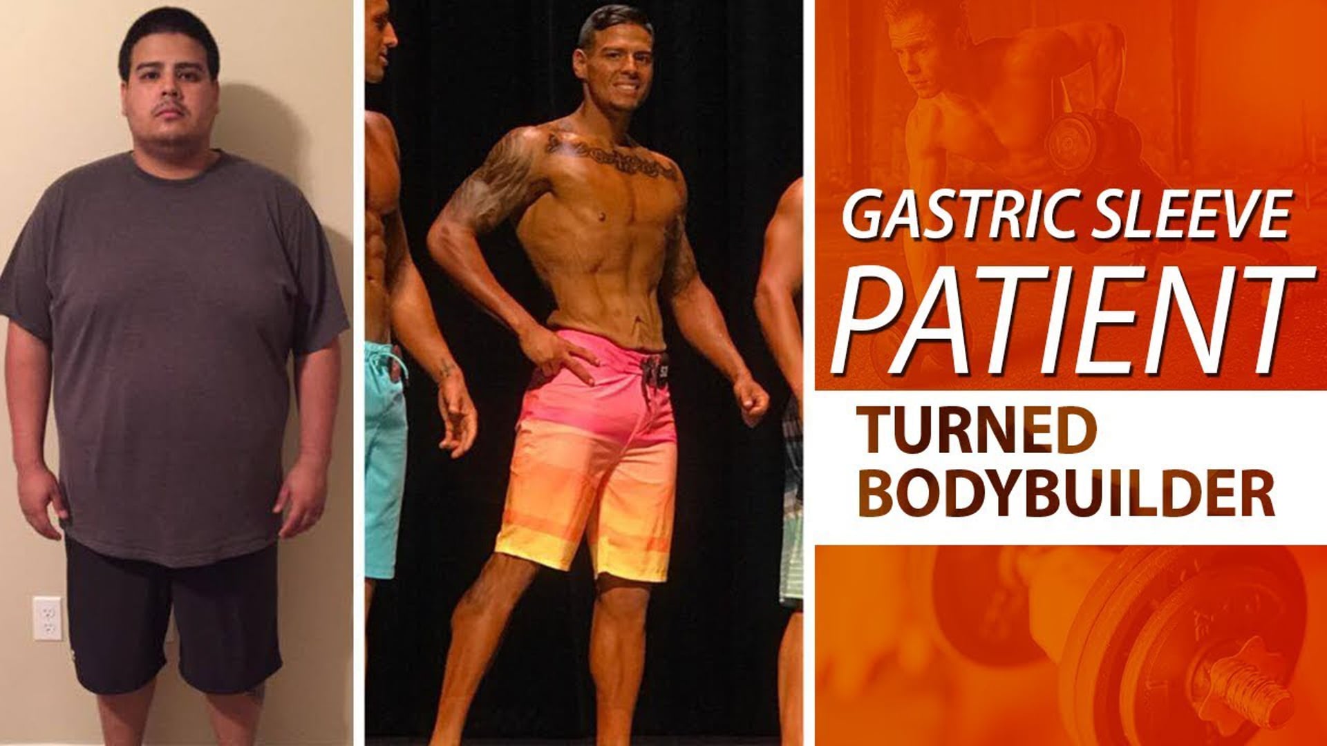 Kevin Ayala – Gastric Sleeve Bodybuilder Transformation