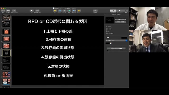 #2 Denture Cafe 第1回「残存歯が１本の場合、RPDよりCDとする方が良い？」