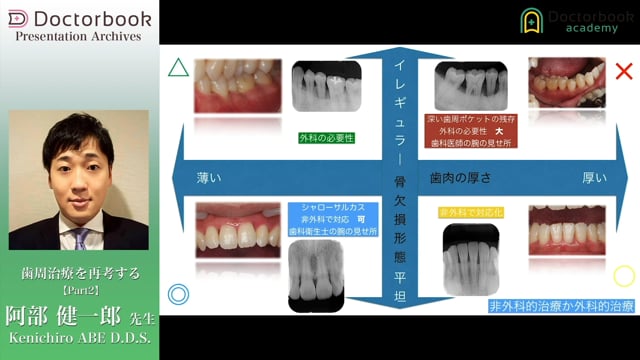 #2 リグロスを用いた歯周組織再生療法