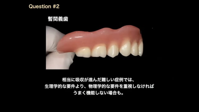 #1 Denture Cafe 第4回「義歯臨床のお悩み相談室」