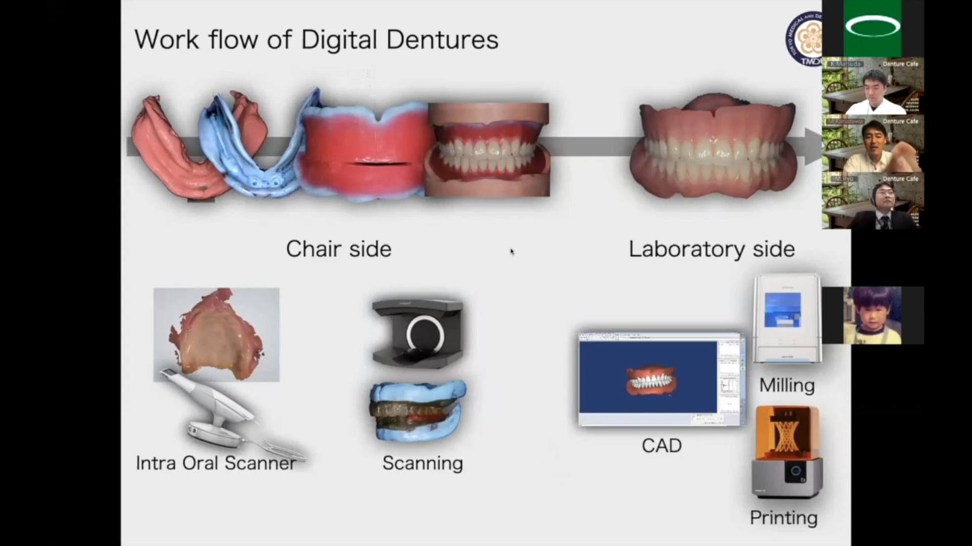 #1 Denture Cafe 第5回「世界のデジタルデンチャー最前線！」〜第一部：デジタルデンチャーってなに？〜