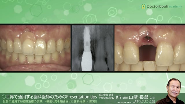 #5 世界で通用する歯科医師のためのPresentation tips -Esthetic and Implantology-【11/07-11/13 プレミアム化】