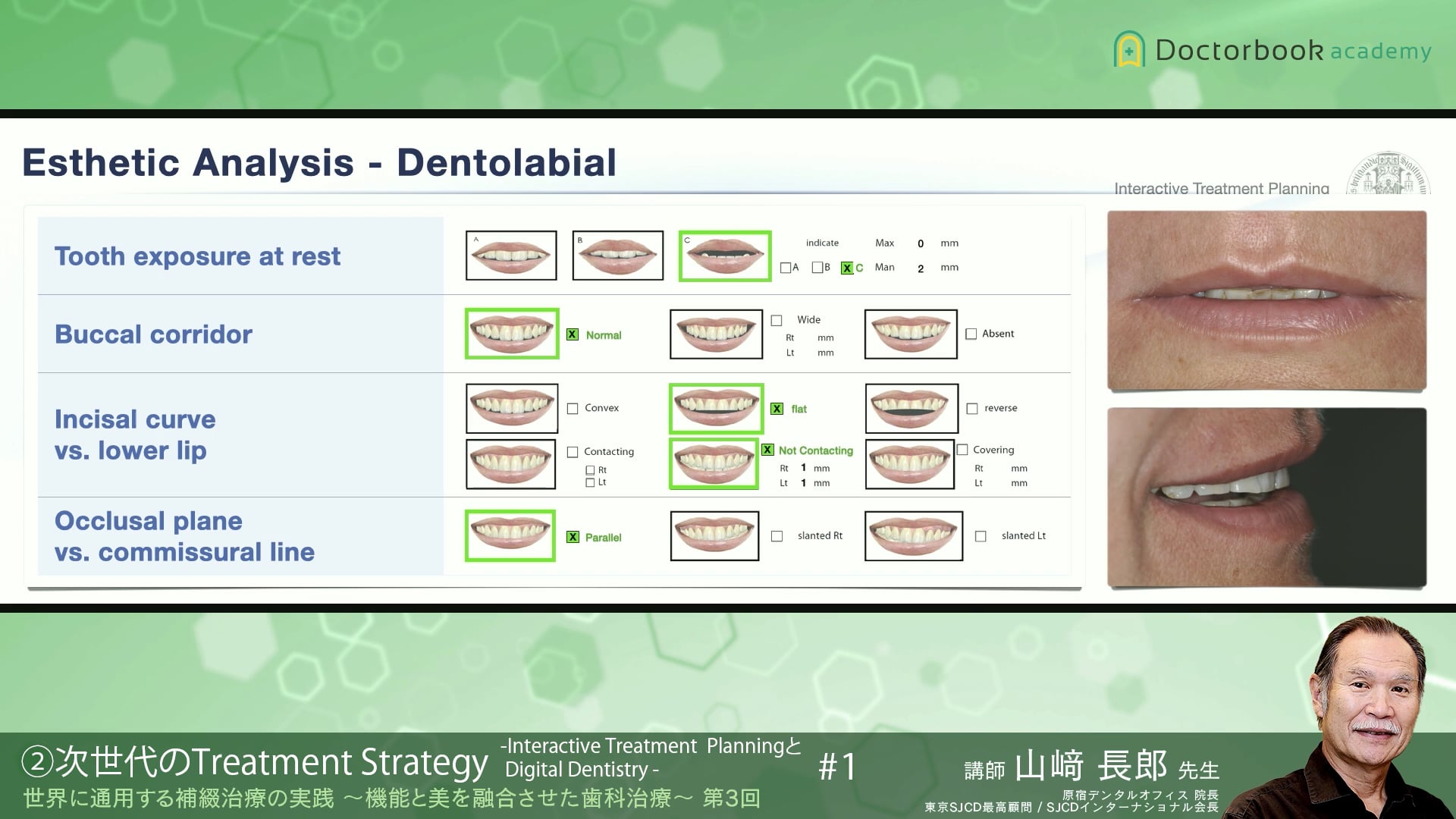 #6 次世代のTreatment Strategy -Interactive Treatment PlanningとDigital Dentistry-