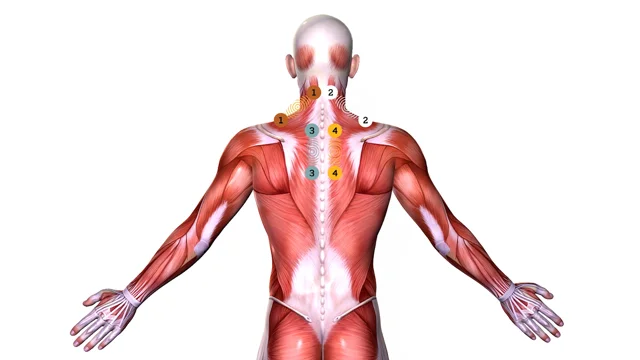 How to Compare TENS Units – A Review of 5 Signal Types — RS Medical