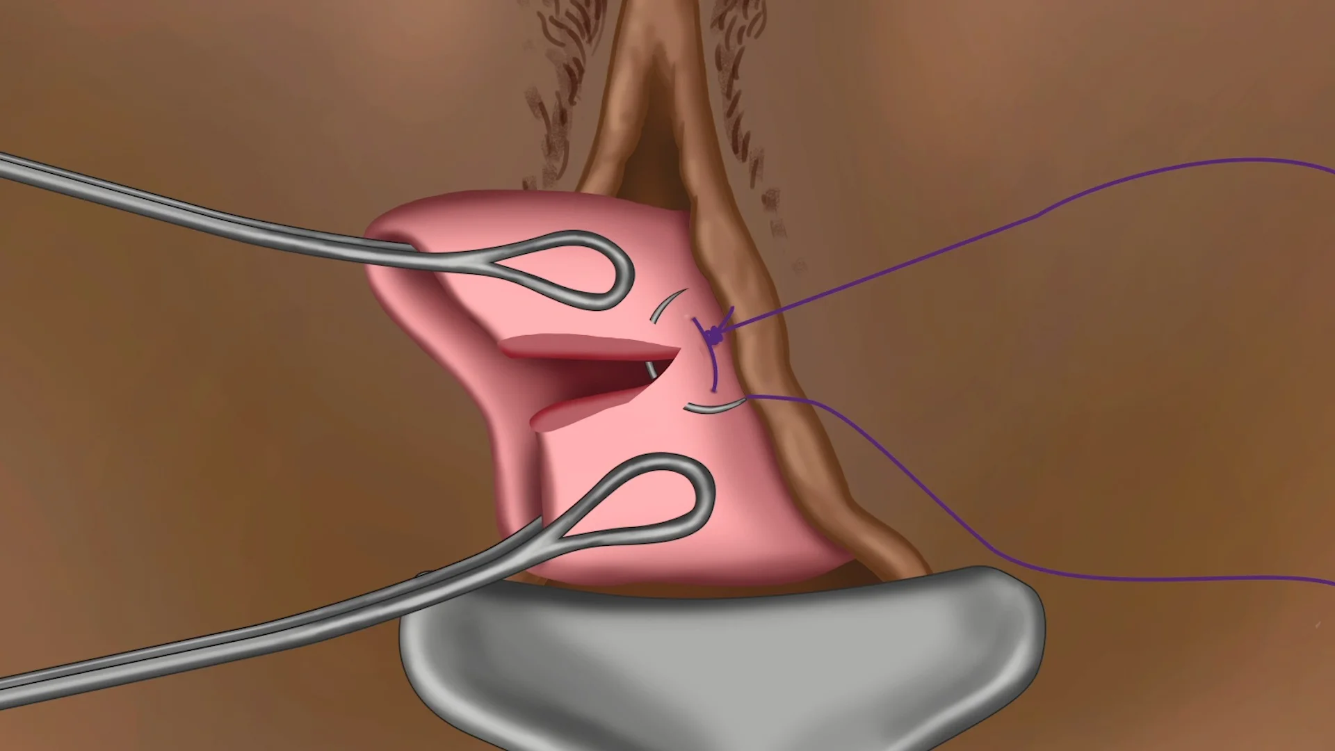Qora prezervativ porno onlayn