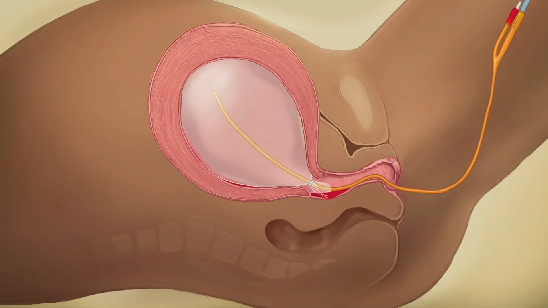 Jinsiy ziyofatda erlar xotinlarini almashtiradilar.
