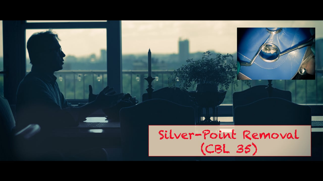 Silver Point Removal (CBL 35) Real World Endo Endodontics Educational Videos