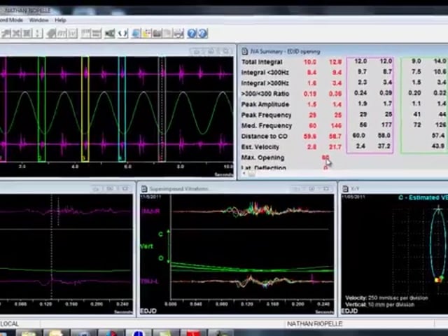 Joint Vibration Analysis - Using the Flowchart