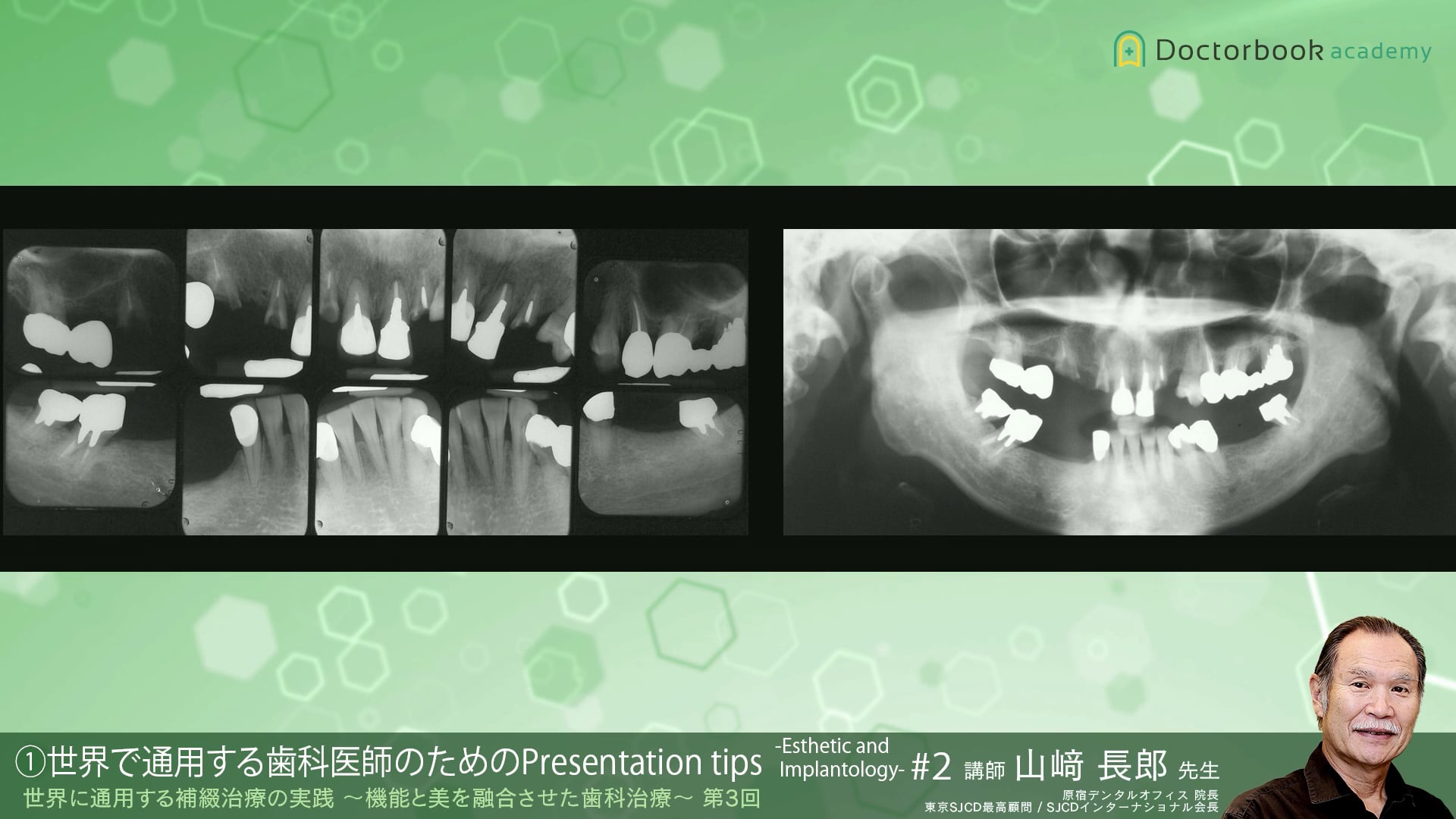 #2 世界で通用する歯科医師のためのPresentation tips -Esthetic and Implantology-【10/17-10/23 プレミアム化】