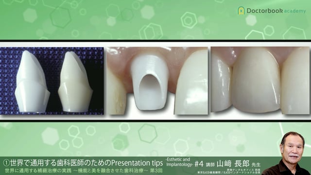 #4 世界で通用する歯科医師のためのPresentation tips -Esthetic and Implantology-【10/31-11/06 プレミアム化】