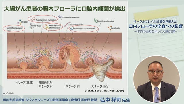  オーラルフレイル対策を見据えた 口内フローラの全身への影響 ~科学的根拠を伴った改善対策~