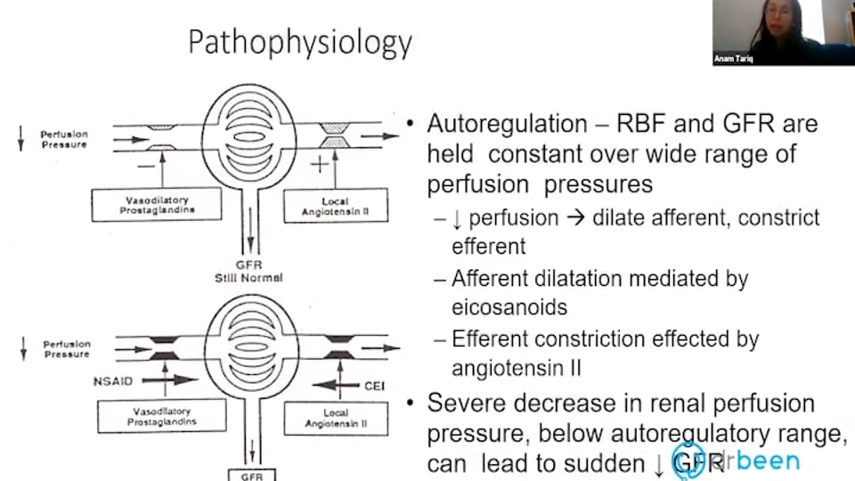 Management of Acute Kidney Injury (Webinar Recording)