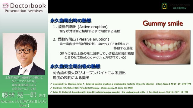 #1 Gingival lineとGummy Smile