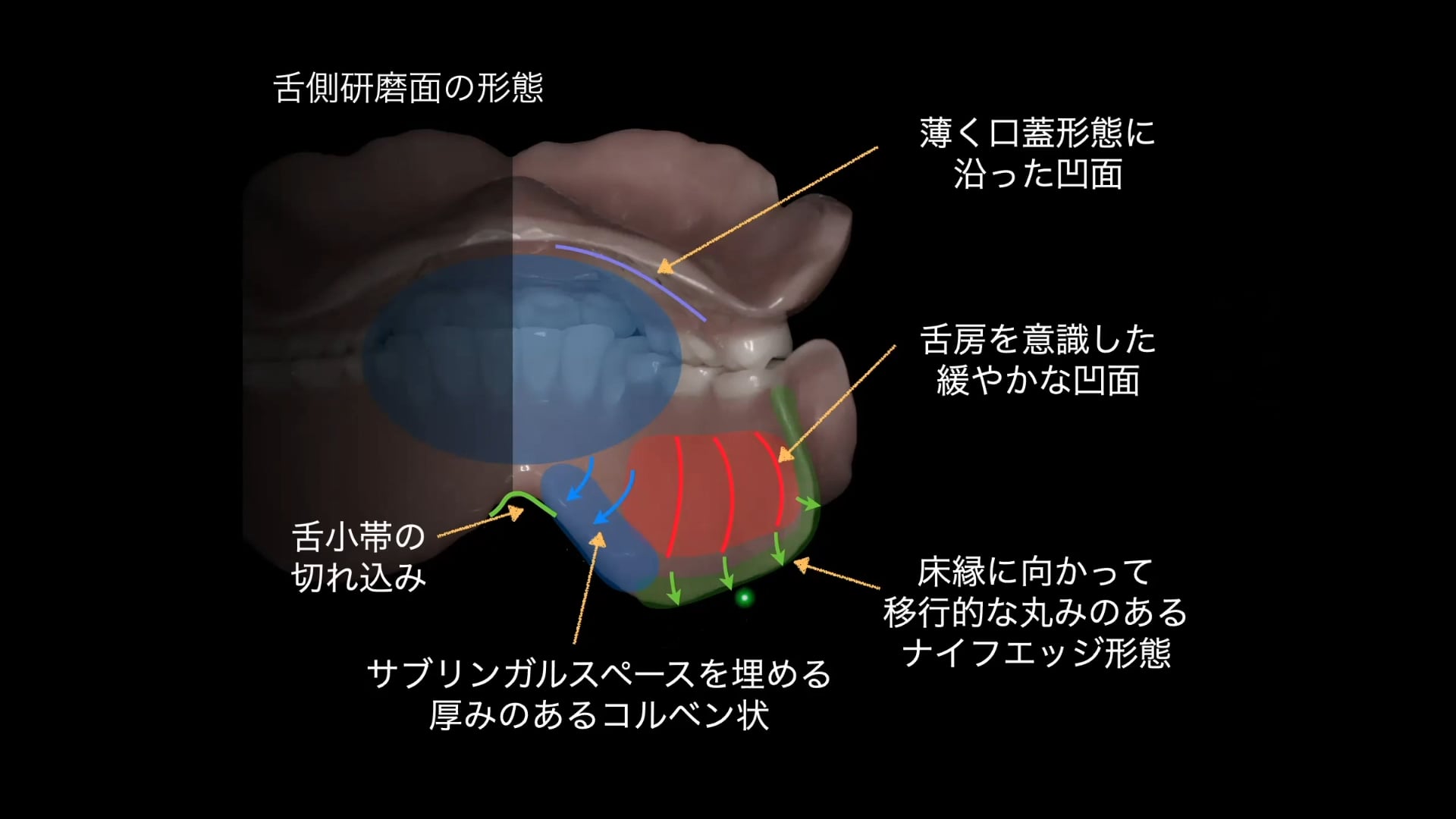 #1 義歯の形態学