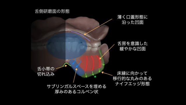 #1 義歯の形態学