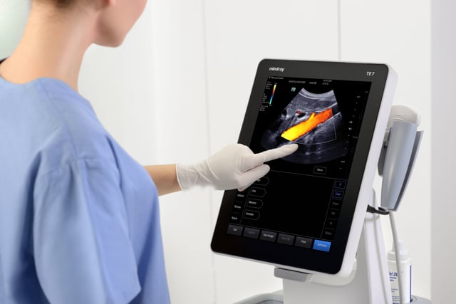 TE7 point-of-care ultrasound system