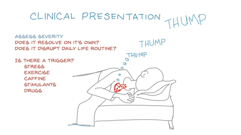 Premature Ventricular Contractions (EKG Interpretation)