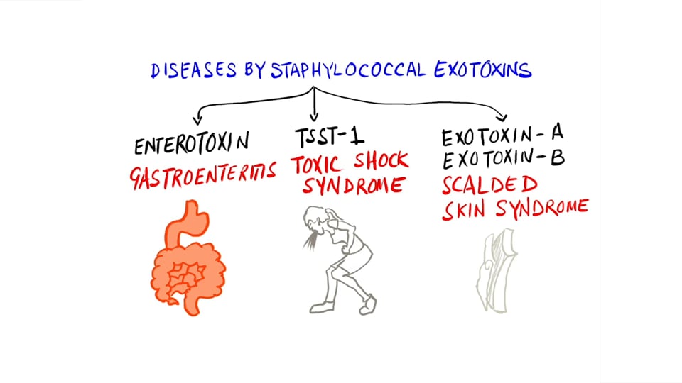 Staphylococcal Gastroenteritis