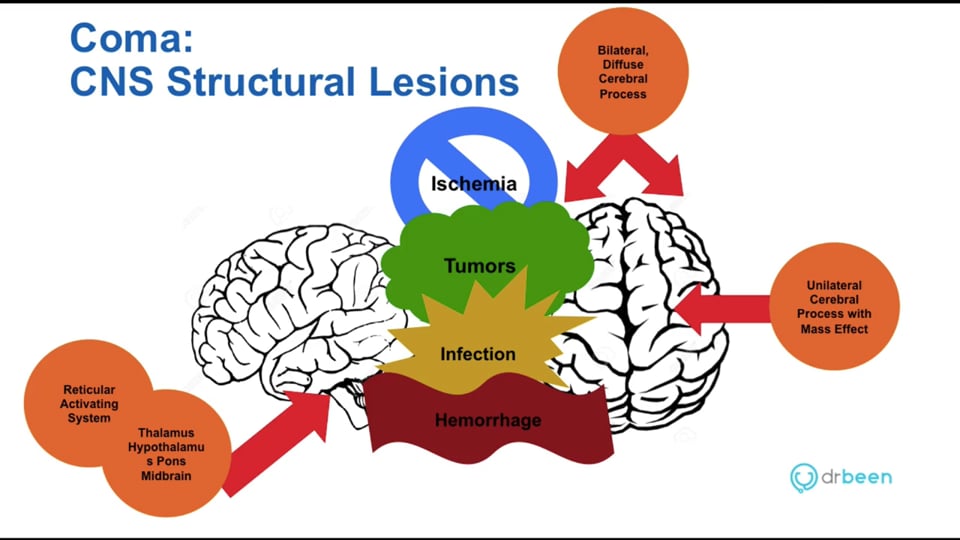 Coma: Definition, Etiologies, and a Case for Review