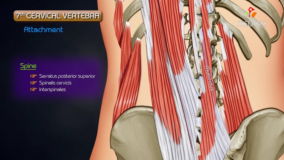 7th Cervical Vertebra 